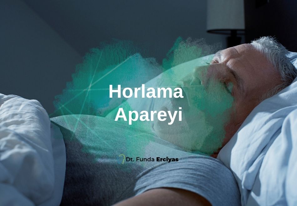 Horlama Apareyi